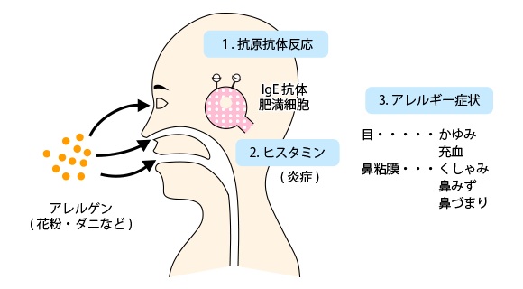 アレルギーの病気とは 一般の皆様へ 一般社団法人日本アレルギー学会